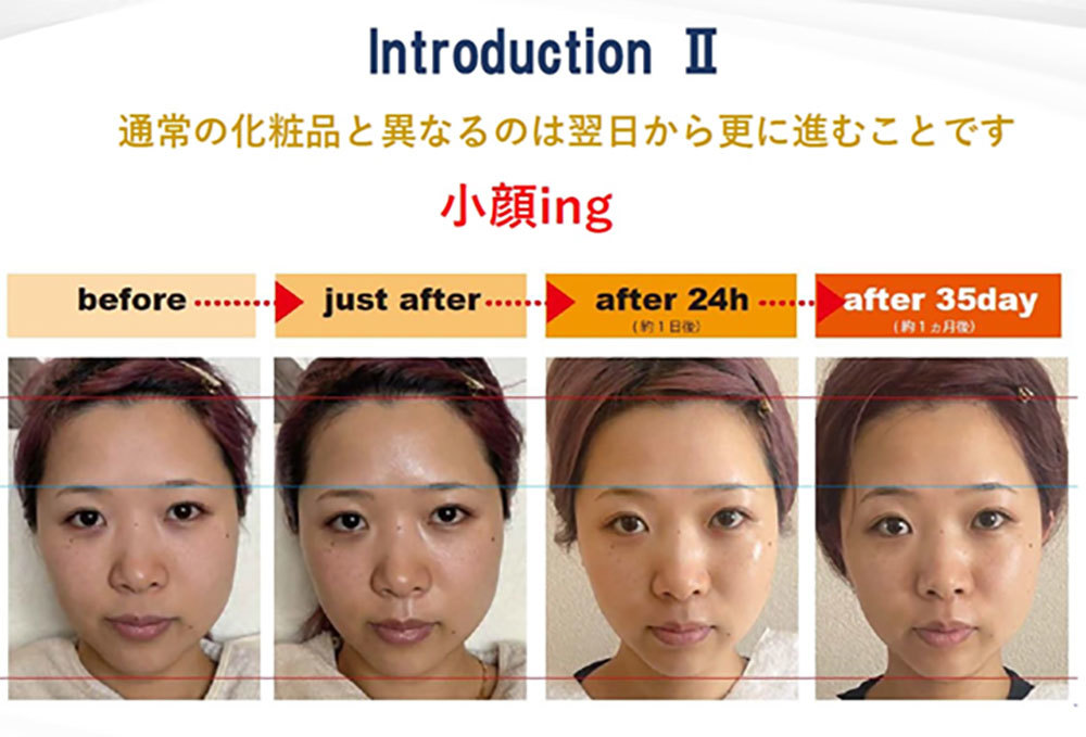 24時間でこんなに小顔に!? 最先端「波動美容」の実力がやばい