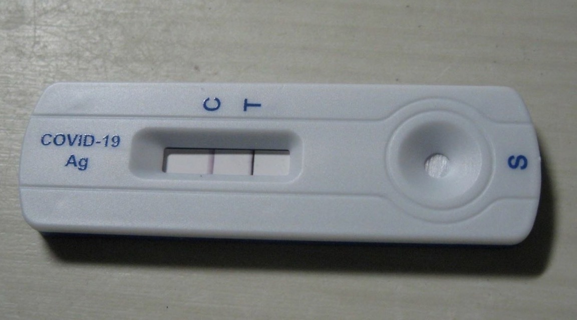 抗原キットで陽性体験談：5類への引き下げが妥当では？