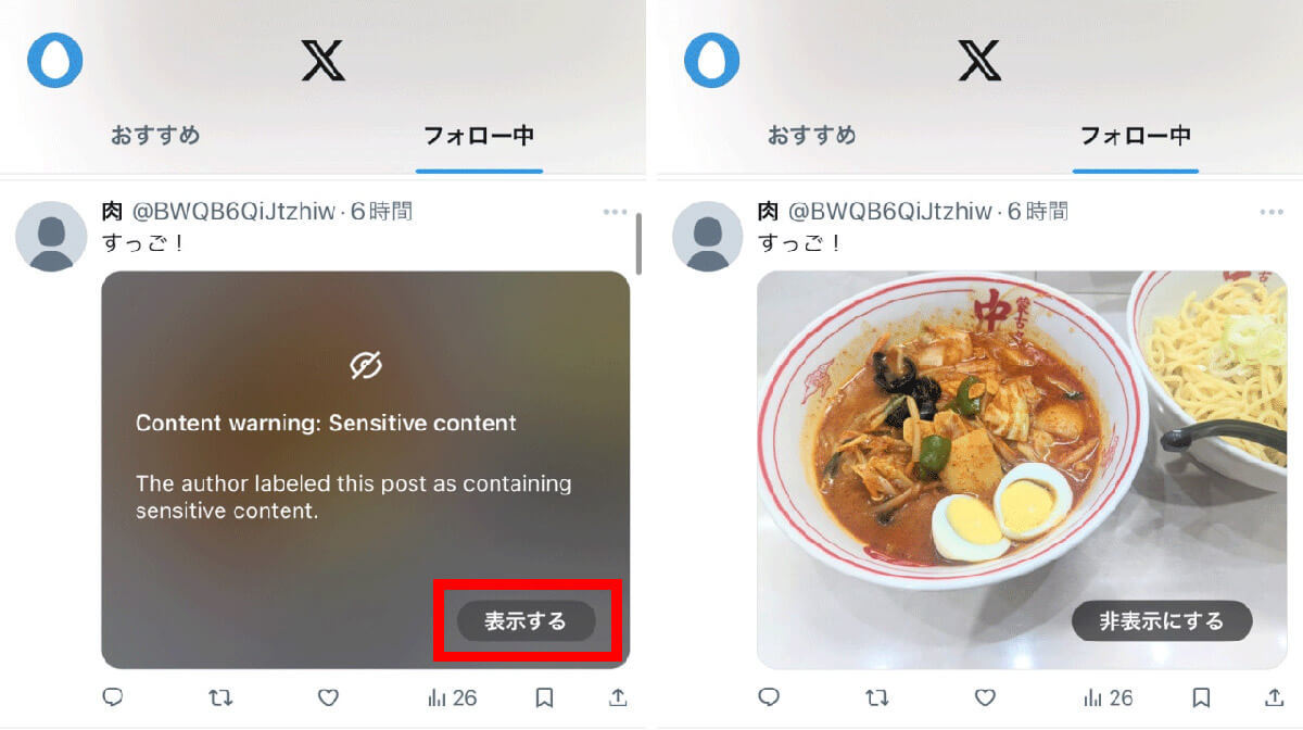 X/Twitter画像に「センシティブな内容」と表示される！iPhoneユーザーの対処法は？