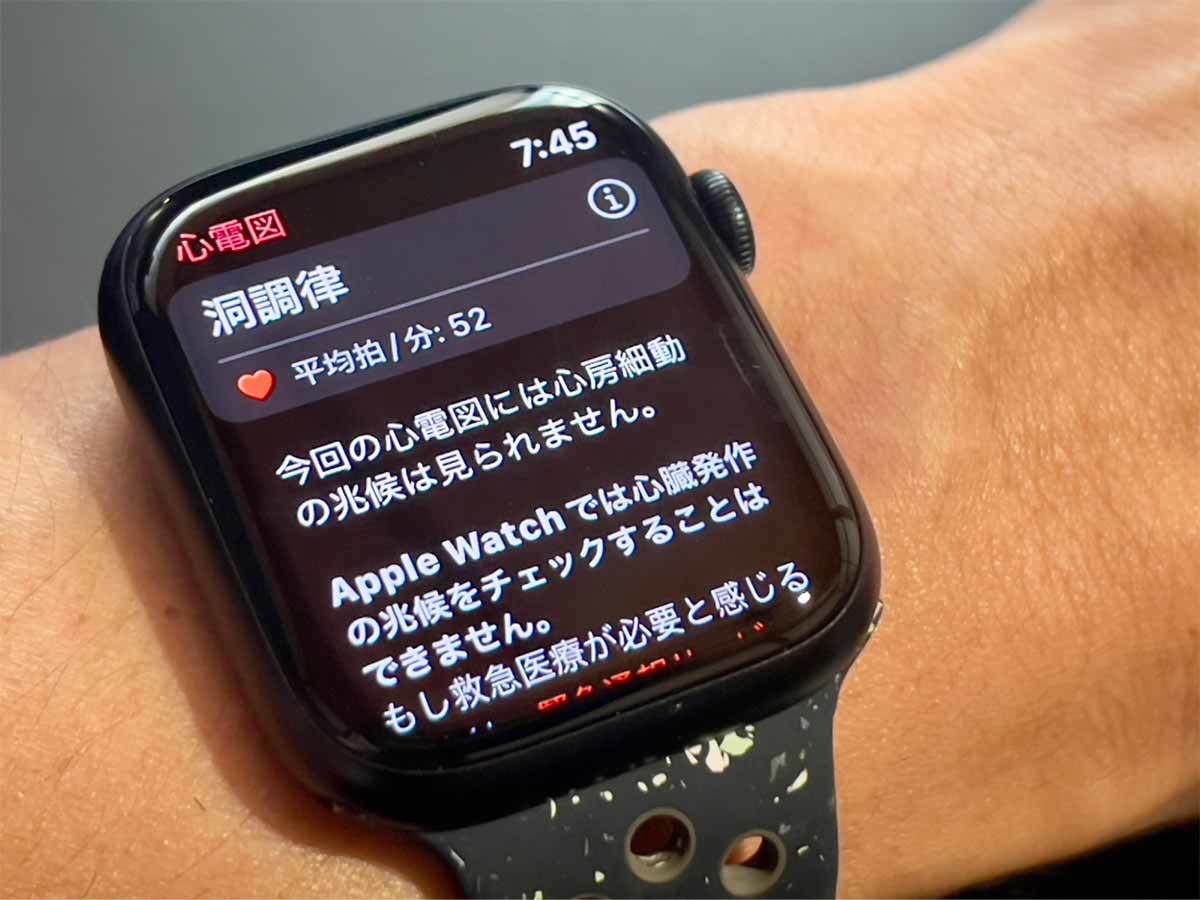 Apple Watch（アップルウォッチ） Series 9でできること・便利なこと11選を購入して実機レビュー