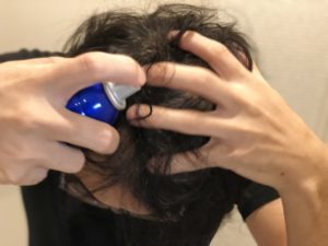 【2021年】男性おすすめ育毛剤人気17選！その効果とは？