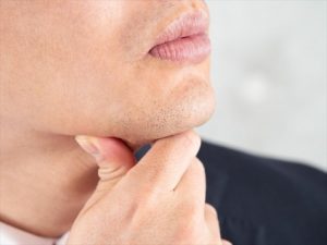 ヒゲ脱毛10回では効果ない？ツルツルになる回数・通う間隔など徹底解説！