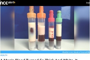 血液が牛乳になった男性… 中性脂肪だらけの「ドロドロの白い血液」に医師も驚愕