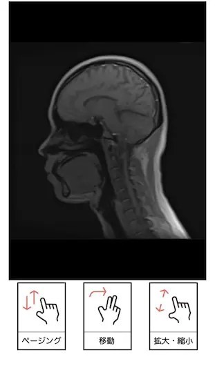 脳の病気の予兆を画像診断でキャッチ！　2万円以下で受けられる「脳ドック」に行ってみた
