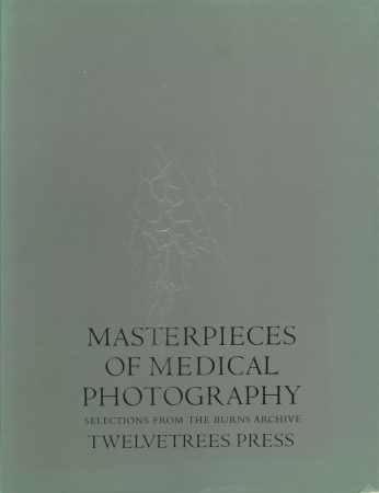 奇形や奇病を記録した危ない医学・医療写真の数々! 驚異の陳列室「書肆ゲンシシャ」が所蔵する奇妙な本