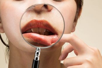 父親がヘルペスに気づかず赤ちゃんにキスし死亡