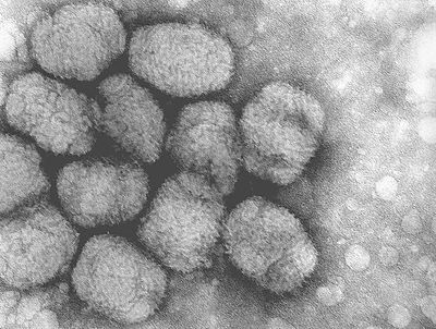 1400年前のヴァイキングの歯から「天然痘ウイルス」を発見！　20世紀に根絶したものと遺伝子が違っていた