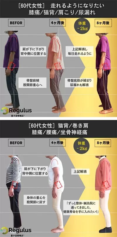 家の中が6割、高齢者の転倒事故が年間6万人超え、熊本で高齢者の体操イベント