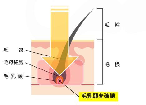 急いで通っても意味がない！？ベストな髭脱毛の期間を徹底解説