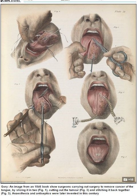【閲覧注意】19世紀の外科手術が怖すぎる、痛すぎる、残酷すぎる！