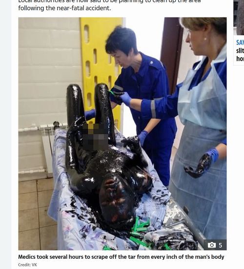 【閲覧注意】廃工場の「有毒液体の沼」にドボン、全身真っ黒で死にかけた男の姿が超絶ヤバすぎる! カミソリで除去…=露