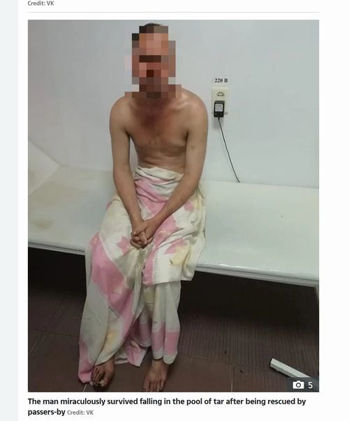 【閲覧注意】廃工場の「有毒液体の沼」にドボン、全身真っ黒で死にかけた男の姿が超絶ヤバすぎる! カミソリで除去…=露