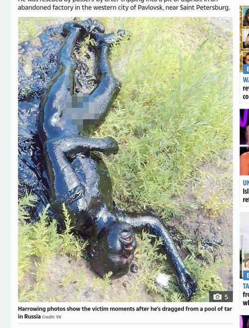 【閲覧注意】廃工場の「有毒液体の沼」にドボン、全身真っ黒で死にかけた男の姿が超絶ヤバすぎる! カミソリで除去…=露