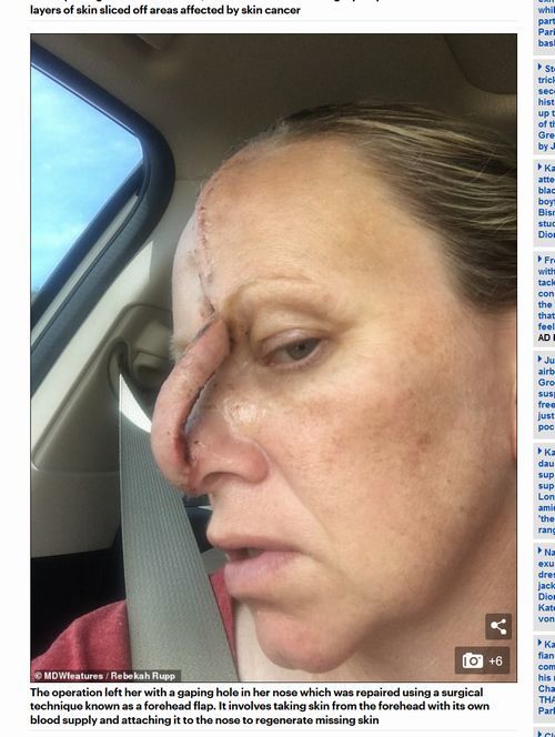 【閲覧注意】日焼けにハマりすぎて顔面崩壊した女が本当に悲惨すぎる…=米