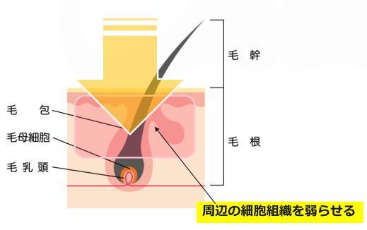 急いで通っても意味がない！？ベストな髭脱毛の期間を徹底解説