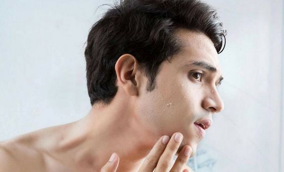 男(メンズ)のニキビ肌予防に効果があるスキンケアとは？正しいケアを解説！