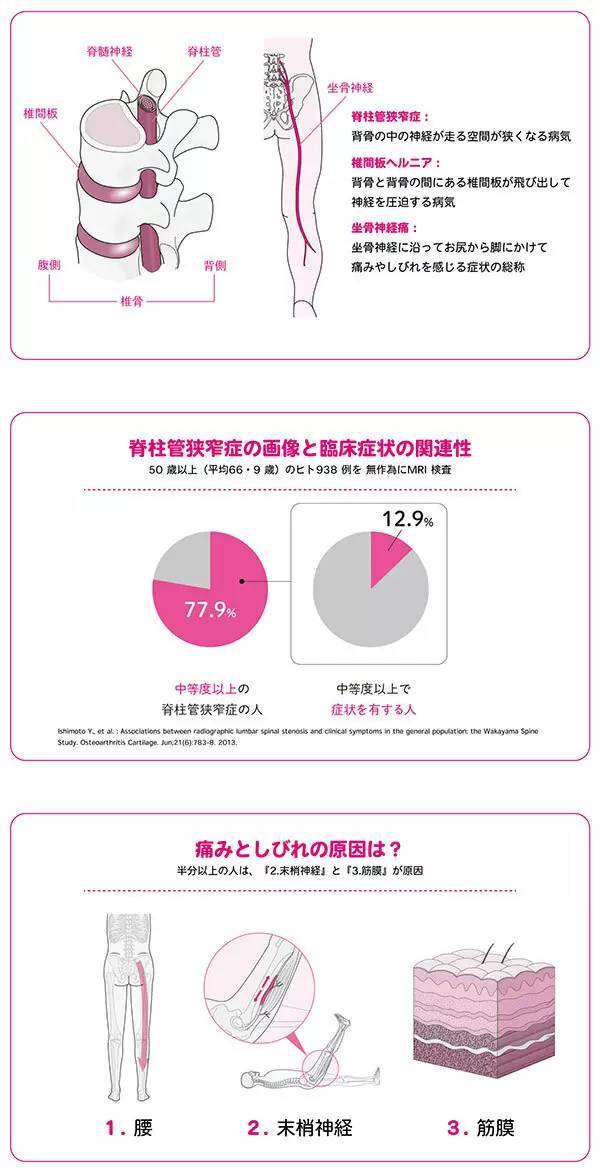 数多くの著名人やプロスポーツ選手が集まる理学療法士が考案！『園部式 脚の痛み・しびれ改善メソッド』