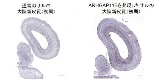 ヒトの脳を進化させた「知恵の実」遺伝子が、サルの脳を巨大化させると判明