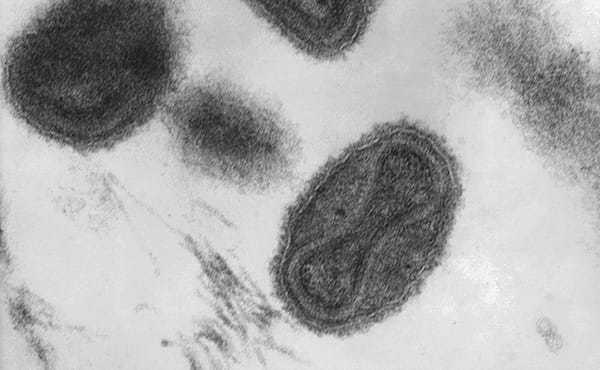 永久凍土に潜む致死的な「ファクターX」ウイルスが気候変動により間もなく解き放たれる可能性がある…科学者が警告!