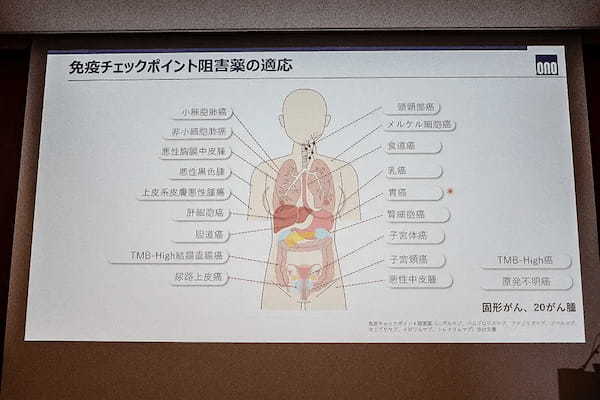 がん治療「第4の柱」「免疫チェックポイント阻害薬」製薬会社がセミナー開催