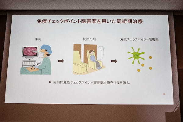 がん治療「第4の柱」「免疫チェックポイント阻害薬」製薬会社がセミナー開催