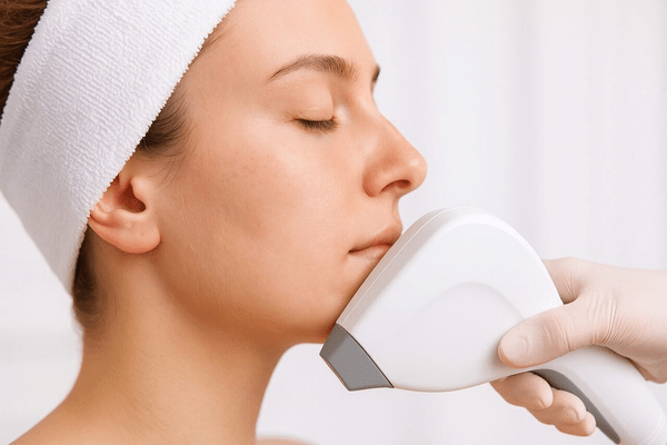 Hair-removal-face
