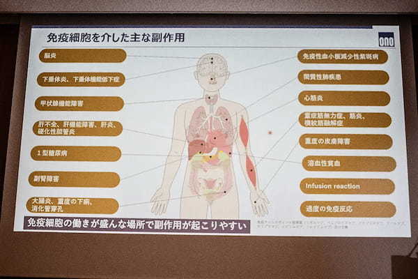 がん治療「第4の柱」「免疫チェックポイント阻害薬」製薬会社がセミナー開催