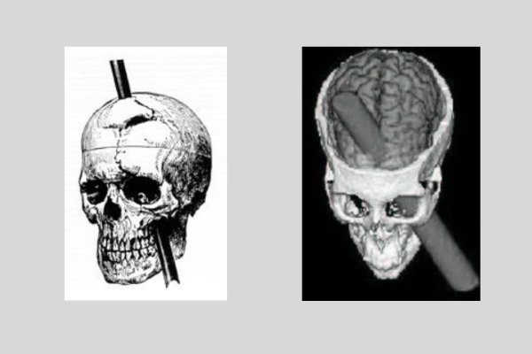 鉄の棒が脳を貫通して人が変わった男性、その原因となった「脳領域」を特定か