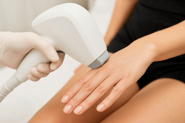 Hair-removal-finger