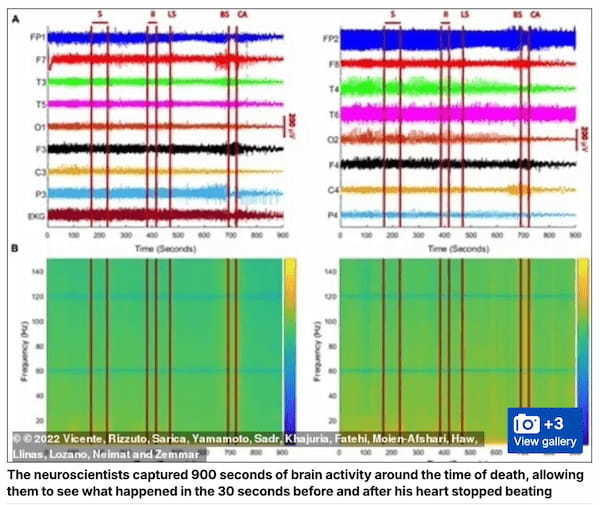 死の直前、脳は何を見ているのか？脳波の記録が示す「人生の回想」