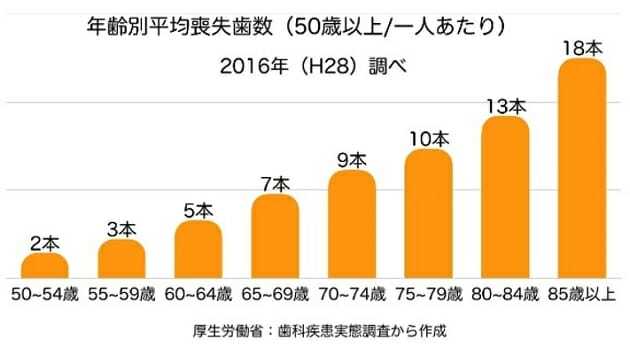 平均的日本人、70歳超で10本の歯を失っている!健康寿命を延ばすカギは入れ歯?