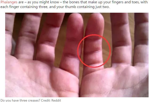 小指に「余分な関節」が存在する人がいる? 発生確率1%以下の超レアケース