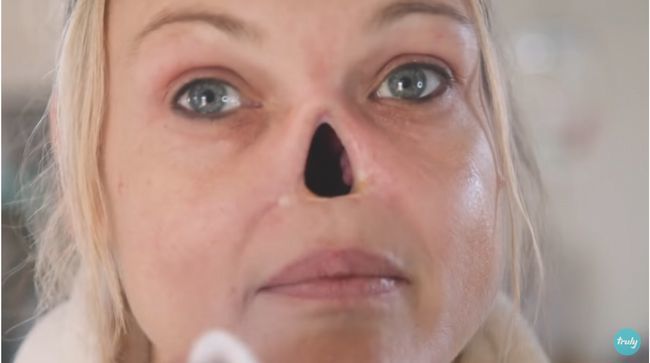 鼻を完全喪失した美女が人工の鼻をつけない理由とは? 壮絶な闘病の果てに辿り着いた自信と美学