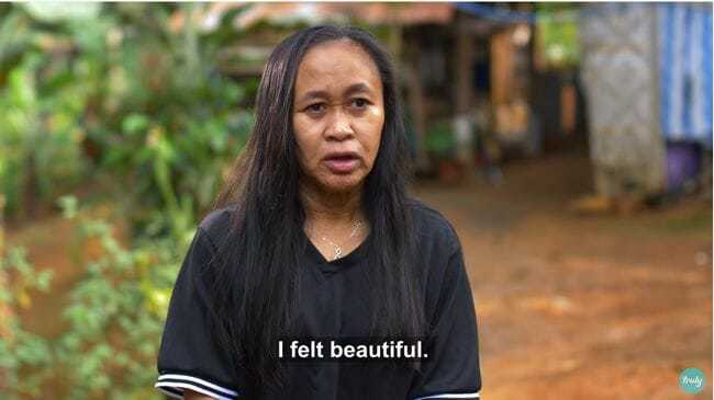 16歳なのに50歳の容姿になった美少女… 日本でも難病指定されている「早老症」とは?=比