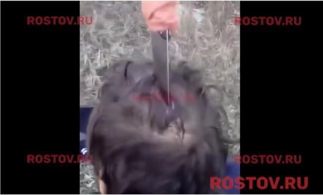 【閲覧注意】“鼻呼吸をするため”頭にナイフを刺した男がヤバい！警察もビビり「動かないで、動かないで」医師も抜き取り拒否！