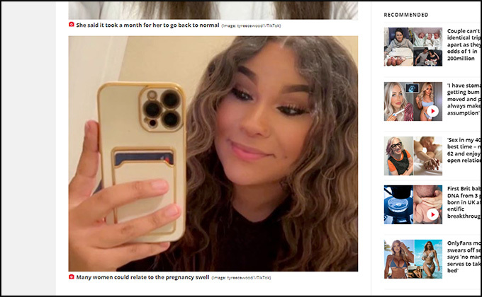 妊娠した女性が「シュレック化」!? 出産前後の激変ぶりにネット激震、別人説も唱えられる