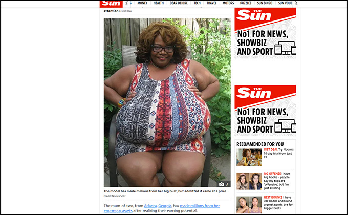「世界最大のおっぱい」を持つ女性たち! 重量30kg長さ1.3m、永遠に胸が成長し続ける違法手術が存在!? 生活上の困難といじめられた過去を告白…