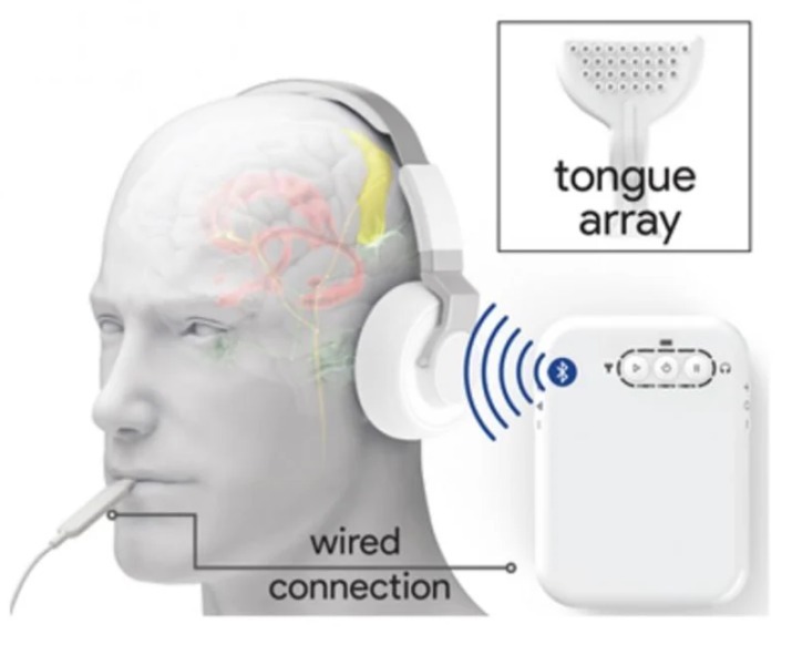 耳鳴りに効く”世界初の治療装置”が開発される！ 「舌」を電極で刺激