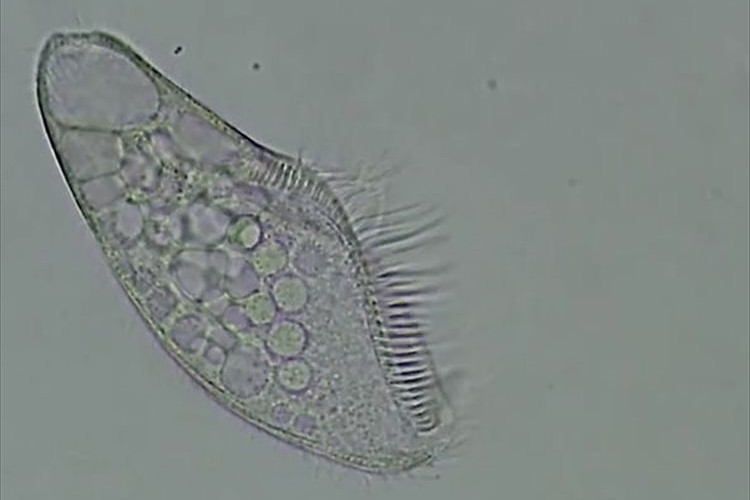 【貴重映像】「大きさに関係なく、命というのははかない」単細胞生物が最期を迎える瞬間の映像が悲しい