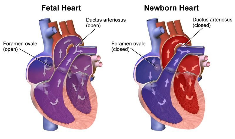 人生「初めての呼吸」で赤ちゃんの心臓と肺は一瞬で変化する