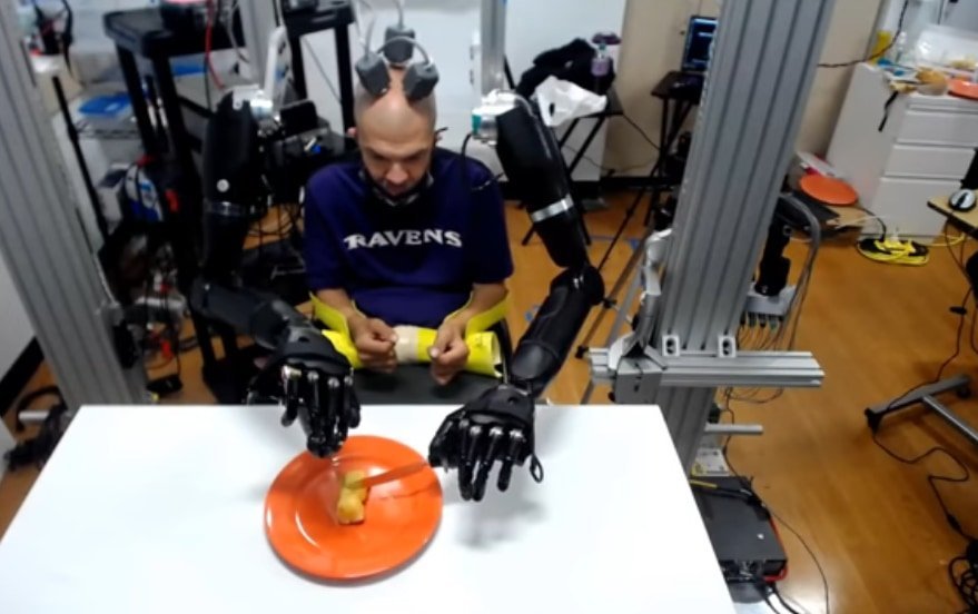 四肢麻痺患者が「脳に電極アレイを埋め込み」ロボットアームを操ることに成功！
