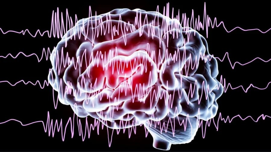 脳に電極を刺し「うつ病スイッチ」を刺激する臨床試験が開始される